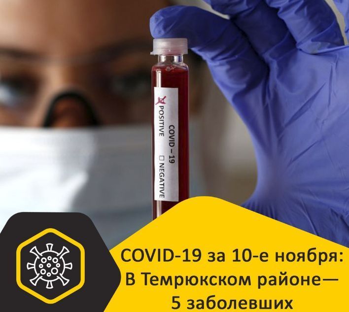Статистика заболевания COVID-19 на Кубани за 10-ое ноября: заразились 150 человек; выздоровели – 60; умерли – 2 